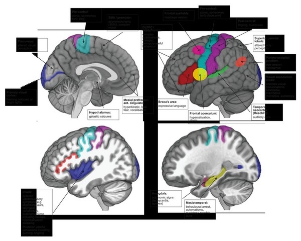 Người chơi có cách nào nhận diện vùng nhiễu dự đoán hay không?
